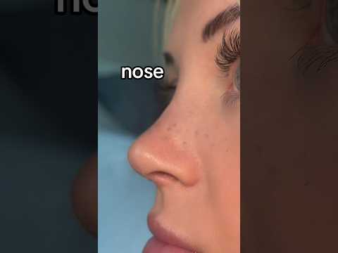 FACIAL HARMONY VS FACIAL FEATURES #trends #viral