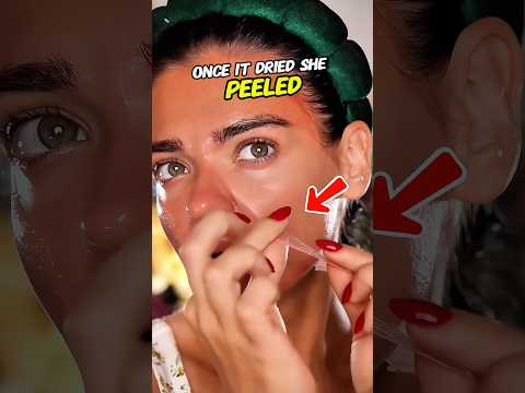 She Forgot SUNSCREEN… Then Her Face Started Peeling 😳🍅☀️