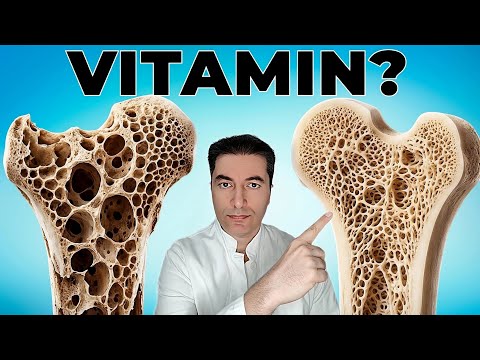 The #1 Vitamin to STOP Osteoporosis After 50