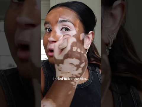 Born to be both ♥️♥️ #vitiligo #skin #makeup #makeuplover #trending #girls #makeupshorts #love