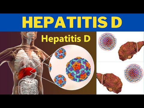 Hepatitis D (HDV) - How do you get hepatitis D? | 247nht